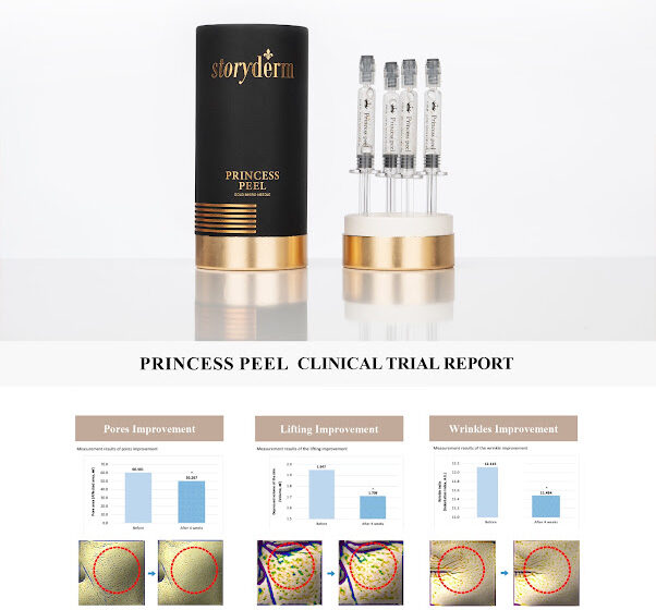 إطلاق “Princess Peel” المعاد تجديده من Storyderm بتقنية المايكرونيدل الذهبية